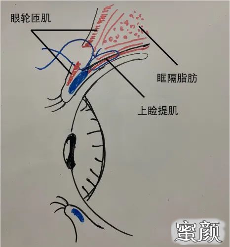 案例图片