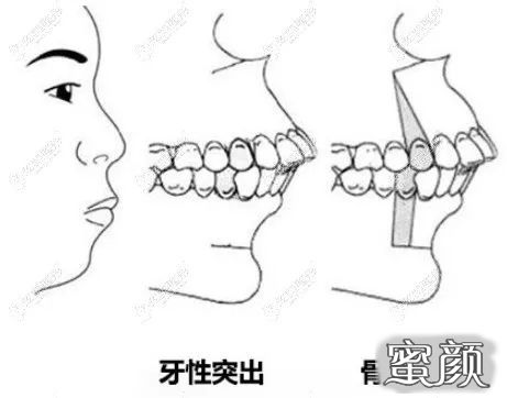 案例图片