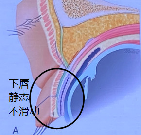 案例图片