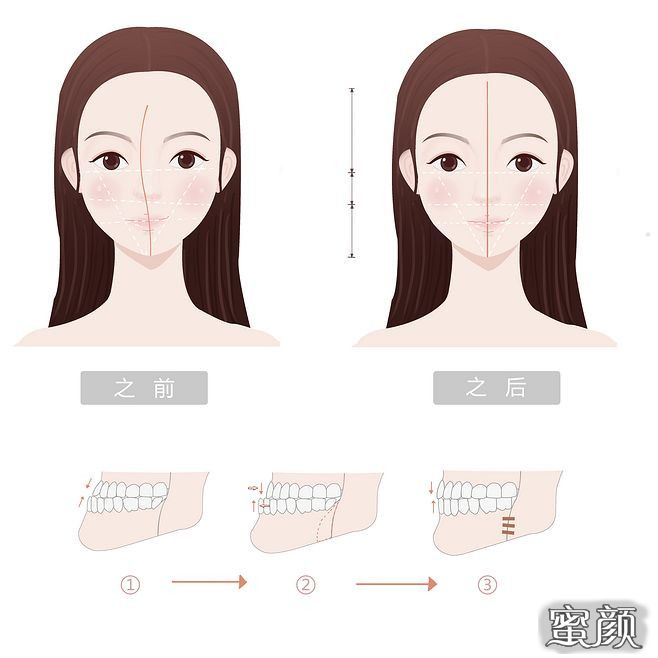 案例图片