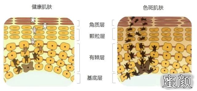 案例图片