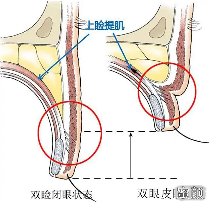 案例图片