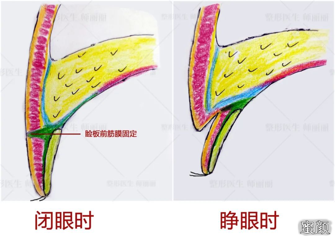 案例图片