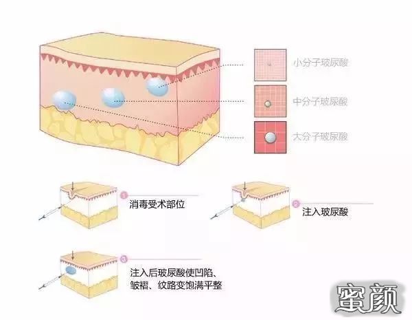 案例图片