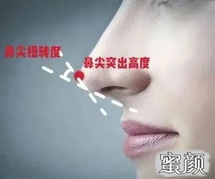 案例图片