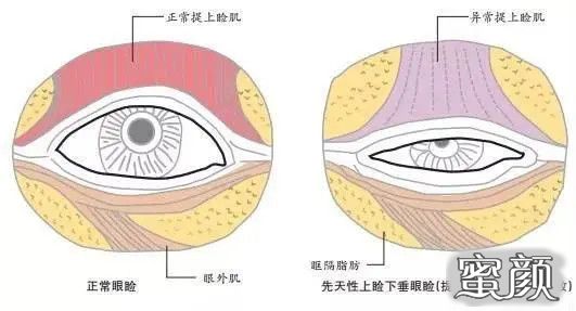 案例图片