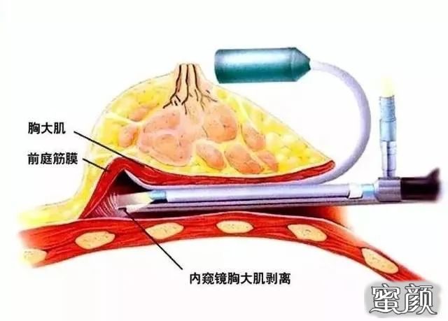 案例图片