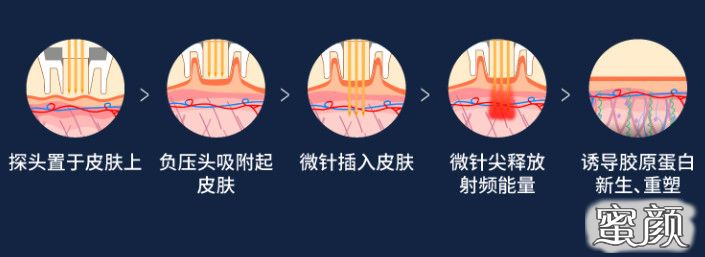 案例图片