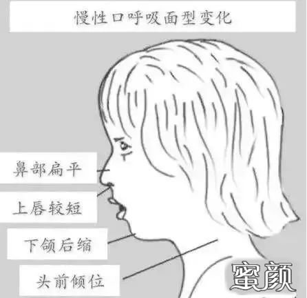 https://img.yiyiaimei.com/mnt/timg/210710/202201M43-11.jpg