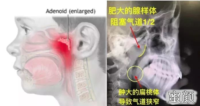 案例图片