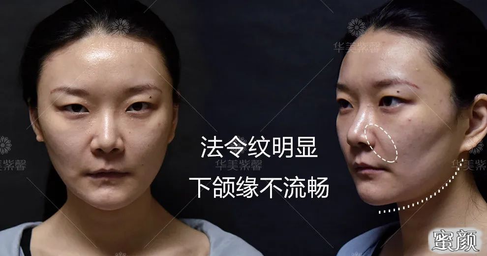 https://img.yiyiaimei.com/mnt/timg/210725/1U454N40-1.jpg