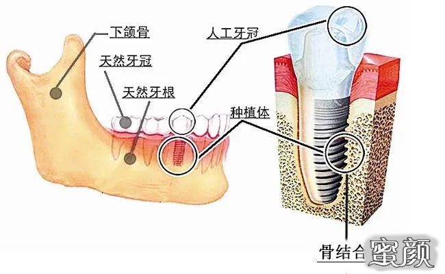 案例图片