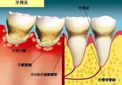 案例图片