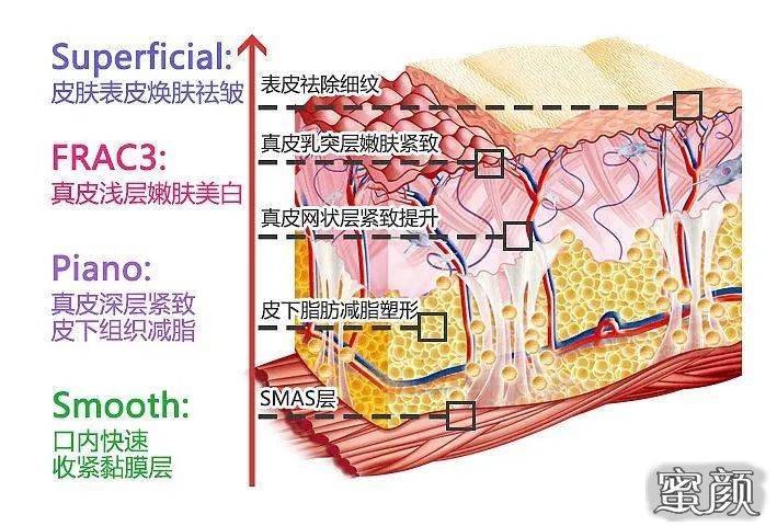 案例图片