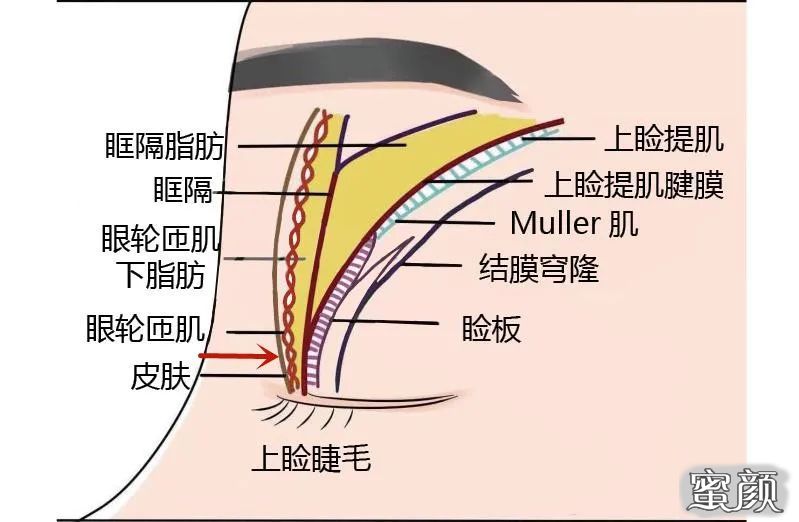 案例图片