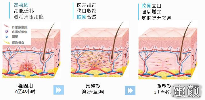 案例图片