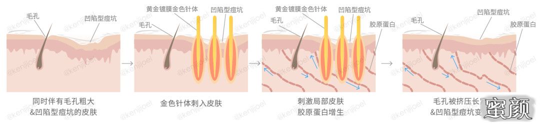 案例图片