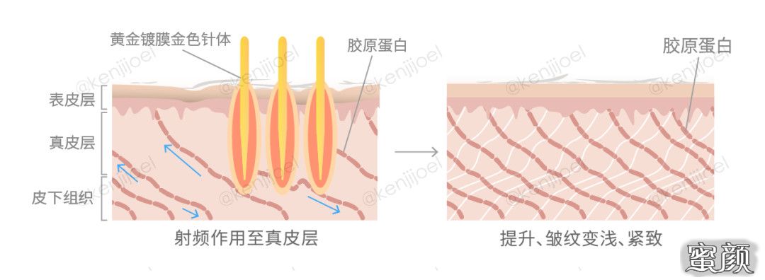 案例图片