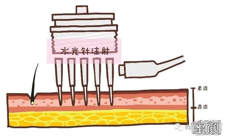 案例图片