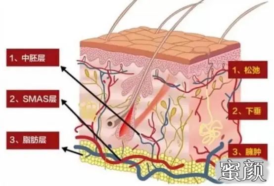 案例图片