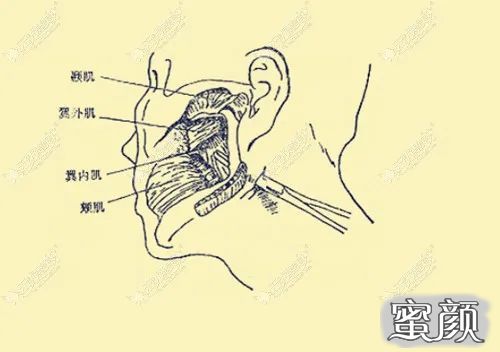 案例图片