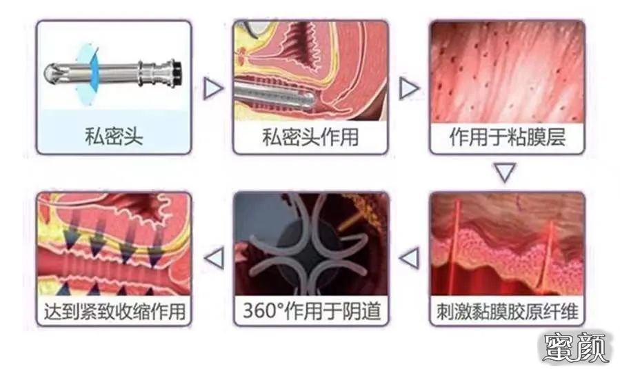 案例图片