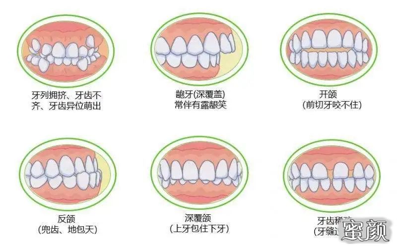 案例图片