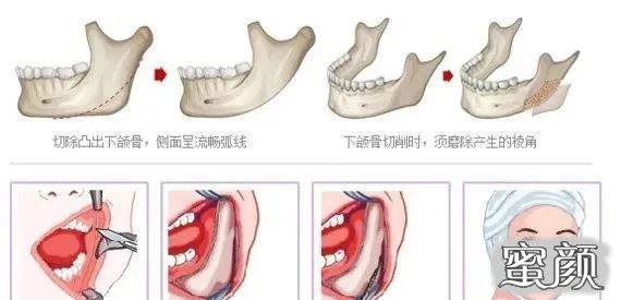 案例图片