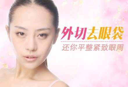 深圳外切去眼袋-