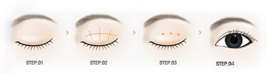 https://img.yiyiaimei.com/timg/160222/124G54632-1.jpg