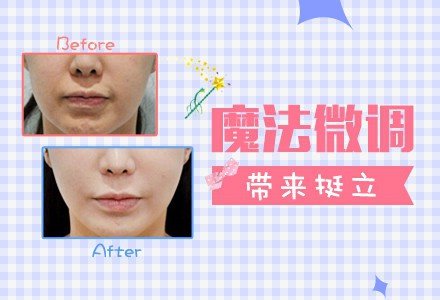 重庆伊婉玻尿酸注射隆鼻-