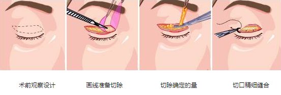 案例图片