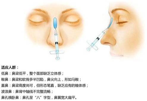 案例图片