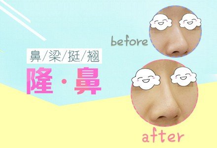北京伊婉玻尿酸注射隆鼻-