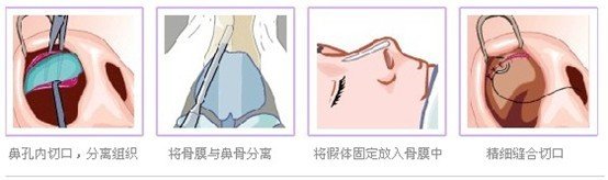 案例图片