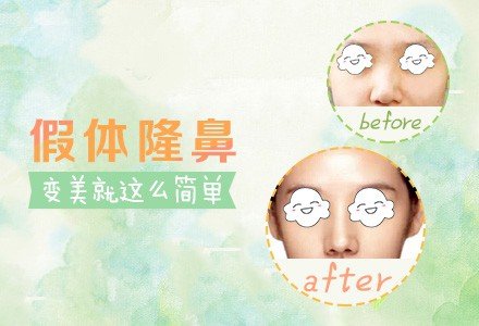 郑州合资硅胶假体隆鼻-