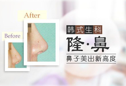 福州韩式生科硅胶假体隆鼻-