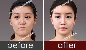 https://img.yiyiaimei.com/timg/160222/132141H40-0.jpg