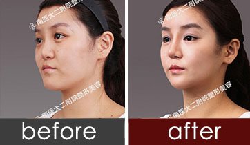 https://img.yiyiaimei.com/timg/160222/1321421449-1.jpg