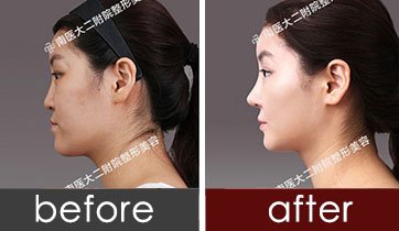 https://img.yiyiaimei.com/timg/160222/13214261U-2.jpg