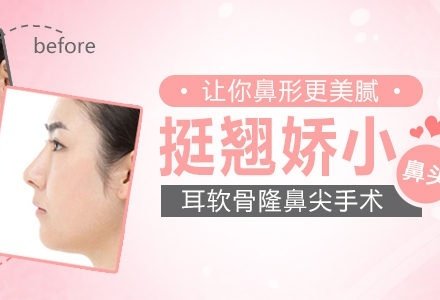 成都耳软骨隆鼻尖手术-