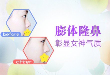 南昌进口膨体隆鼻术-