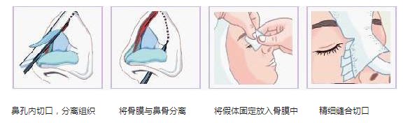 案例图片