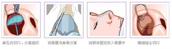 案例图片