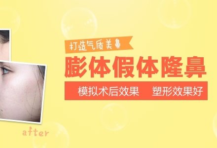 成都膨体假体隆鼻-