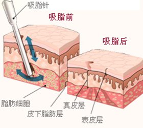 案例图片