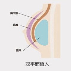 案例图片
