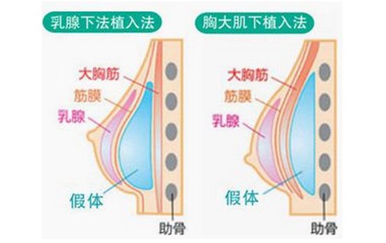 案例图片