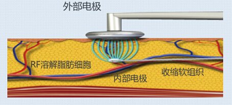 案例图片