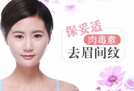 贵阳保妥适肉毒素注射去眉间纹-